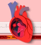 בדיקת קראטין קינאז - תמונת אווירה